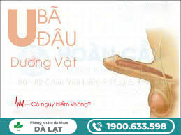 Hình ảnh minh họa